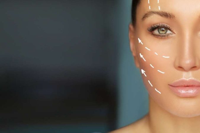 Gros plan sur le visage d'une femme aux yeux verts avec des lignes pointillées blanches sur la joue indiquant des zones de lifting ou d'injection d'acide hyaluronique.